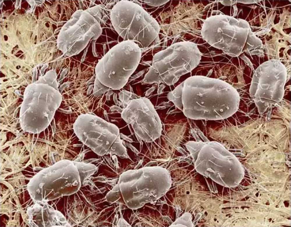 15456208168679697yIr.jpg 螨蟲2.jpg